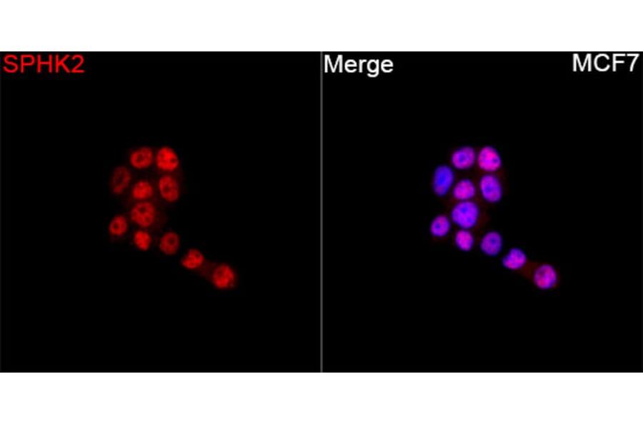 Immunofluorescence - Anti-SPHK2 Antibody (A329871) - Antibodies.com