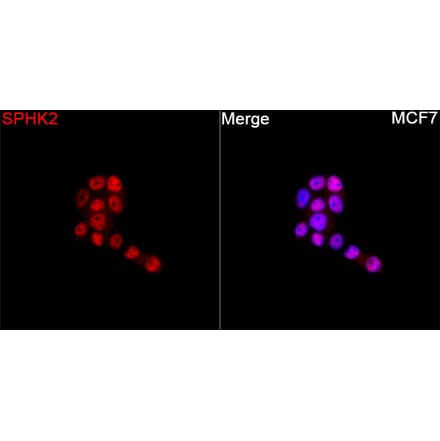 Immunofluorescence - Anti-SPHK2 Antibody (A329871) - Antibodies.com
