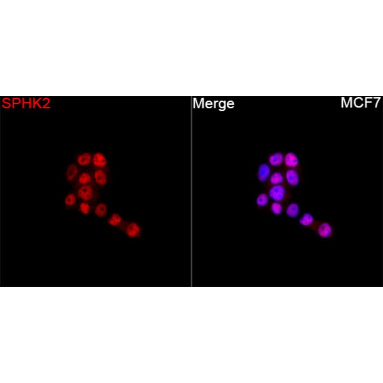 Immunofluorescence - Anti-SPHK2 Antibody (A329871) - Antibodies.com