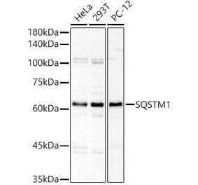 Western Blot - Anti-SQSTM1 Antibody (A329872) - Antibodies.com