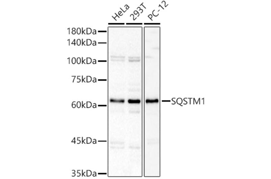 Western Blot - Anti-SQSTM1 Antibody (A329872) - Antibodies.com