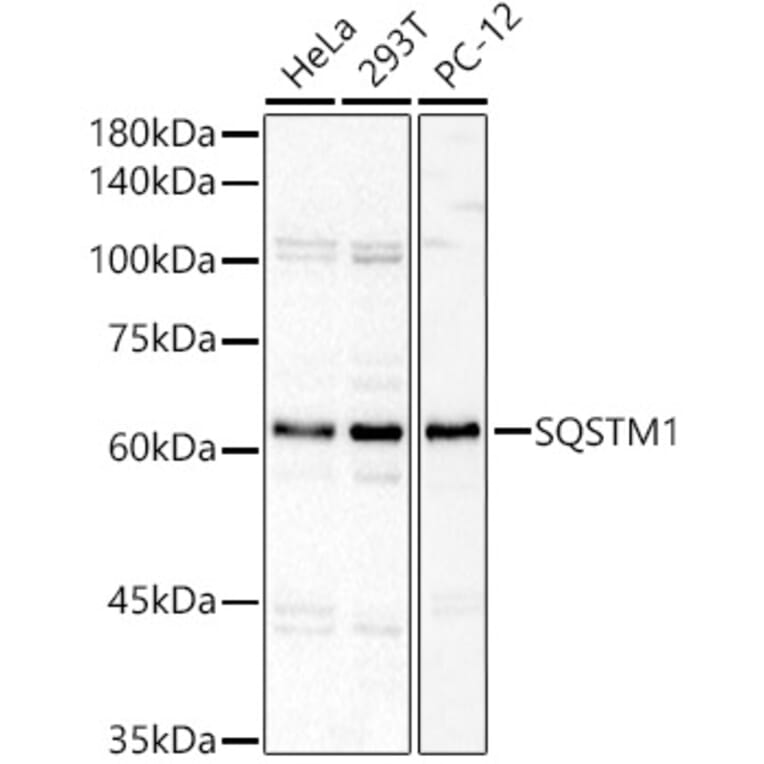 Western Blot - Anti-SQSTM1 Antibody (A329872) - Antibodies.com