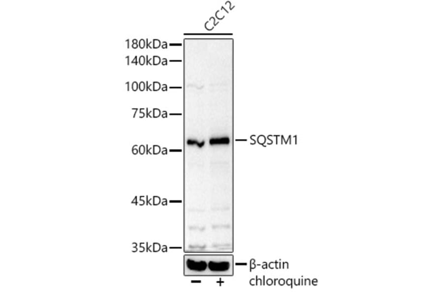 Western Blot - Anti-SQSTM1 Antibody (A329872) - Antibodies.com