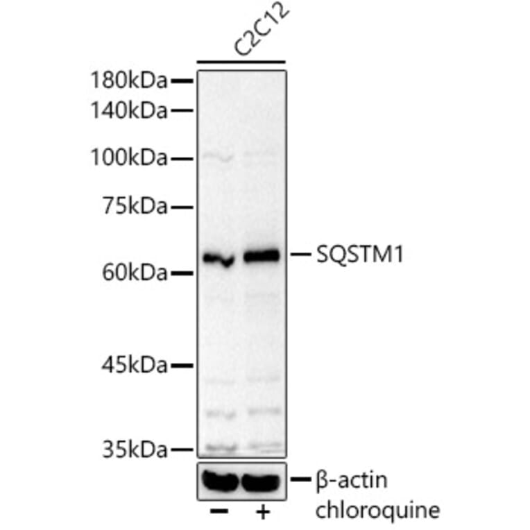 Western Blot - Anti-SQSTM1 Antibody (A329872) - Antibodies.com