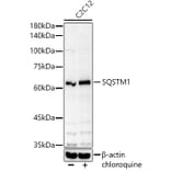 Western Blot - Anti-SQSTM1 Antibody (A329872) - Antibodies.com