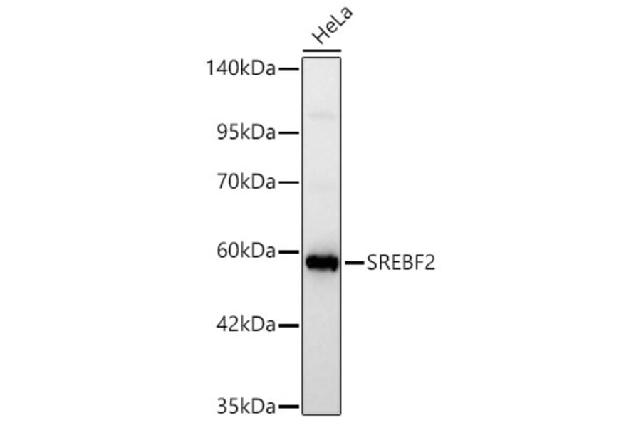 Western Blot - Anti-SREBP2 Antibody (A329873) - Antibodies.com
