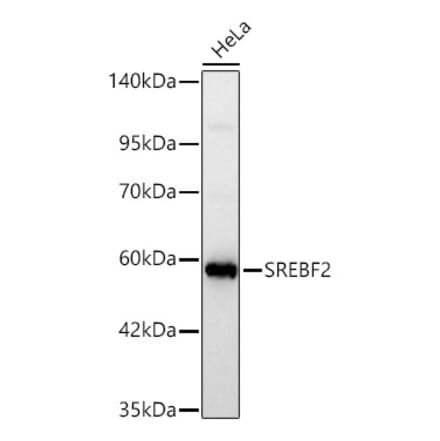 Western Blot - Anti-SREBP2 Antibody (A329873) - Antibodies.com