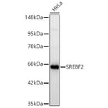 Western Blot - Anti-SREBP2 Antibody (A329873) - Antibodies.com