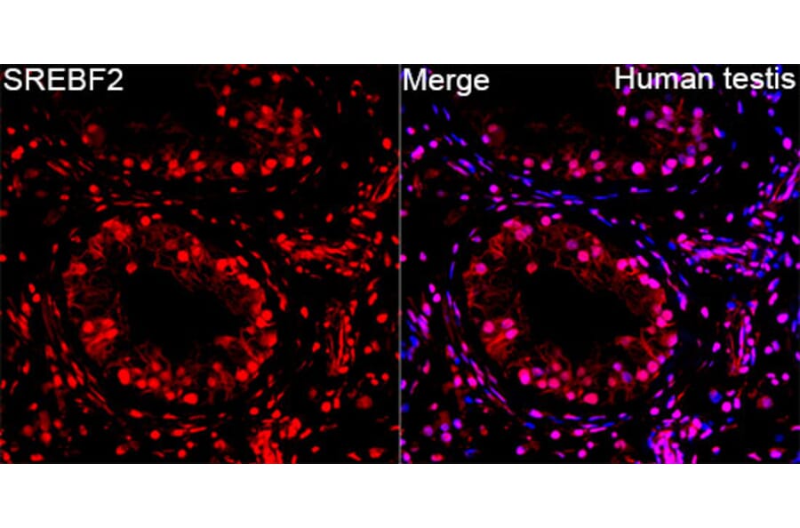 Immunofluorescence - Anti-SREBP2 Antibody (A329873) - Antibodies.com