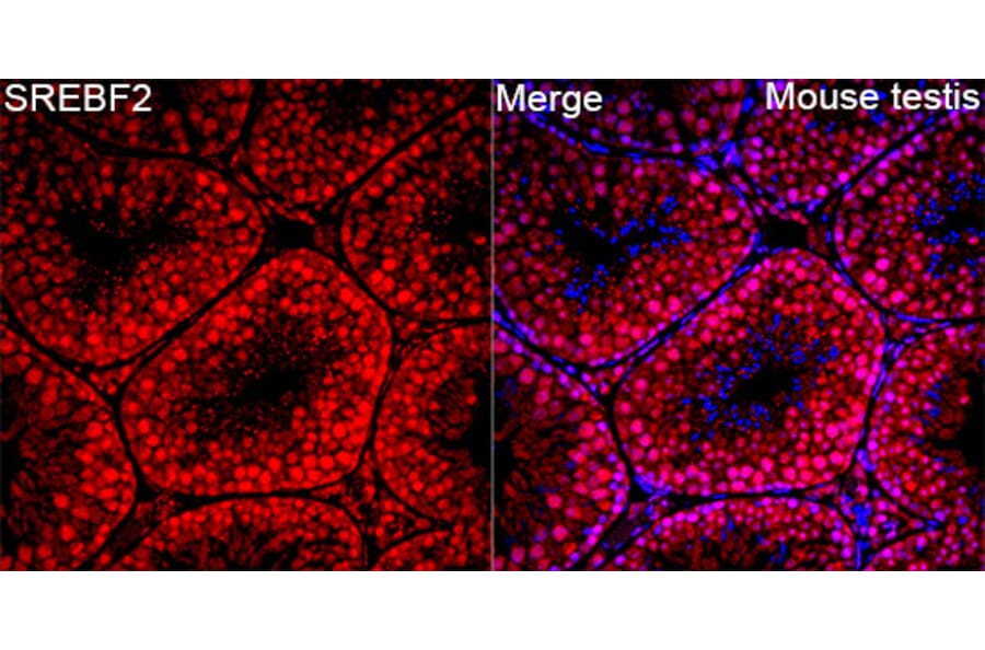 Immunofluorescence - Anti-SREBP2 Antibody (A329873) - Antibodies.com