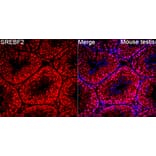 Immunofluorescence - Anti-SREBP2 Antibody (A329873) - Antibodies.com