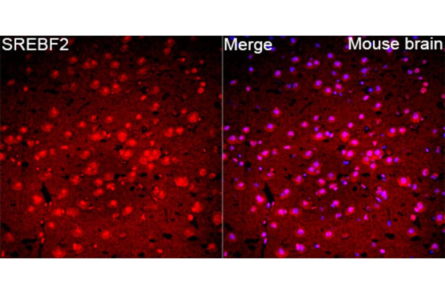 Immunofluorescence - Anti-SREBP2 Antibody (A329873) - Antibodies.com