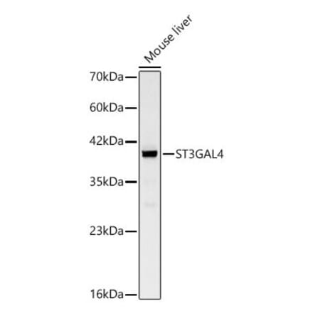 Western Blot - Anti-ST3GAL4 Antibody (A329874) - Antibodies.com