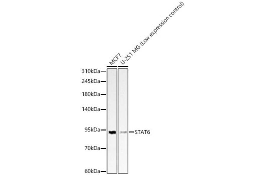 Western Blot - Anti-STAT6 Antibody (A329875) - Antibodies.com