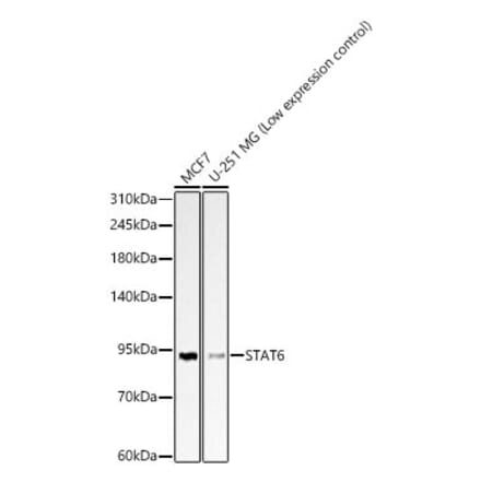 Western Blot - Anti-STAT6 Antibody (A329875) - Antibodies.com