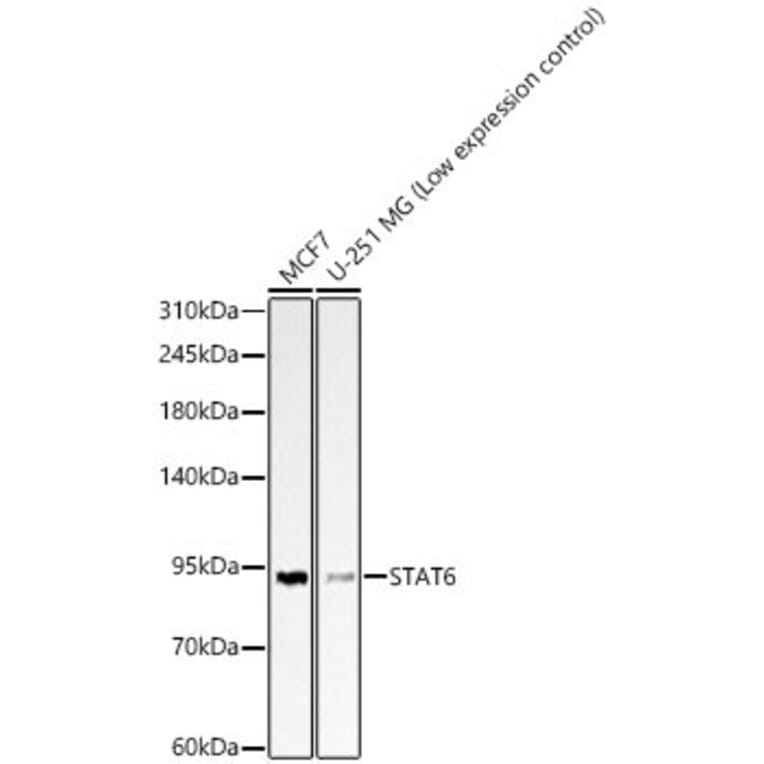 Western Blot - Anti-STAT6 Antibody (A329875) - Antibodies.com