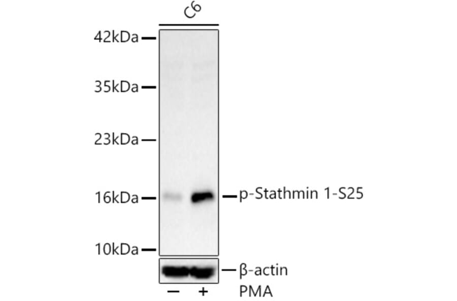 Western Blot - Anti-Stathmin 1 (Phospho S25) Antibody [ARC62298] (A329876) - Antibodies.com