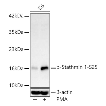 Western Blot - Anti-Stathmin 1 (Phospho S25) Antibody [ARC62298] (A329876) - Antibodies.com