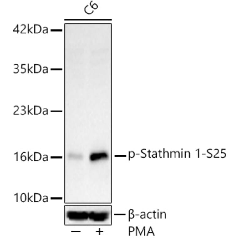 Western Blot - Anti-Stathmin 1 (Phospho S25) Antibody [ARC62298] (A329876) - Antibodies.com