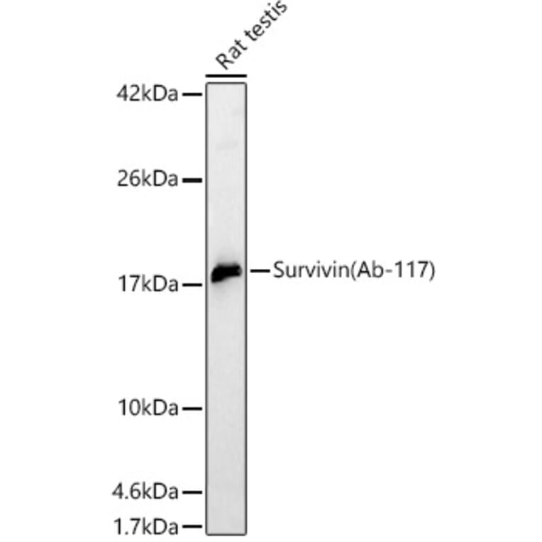 Western Blot - Anti-Survivin Antibody (A329877) - Antibodies.com