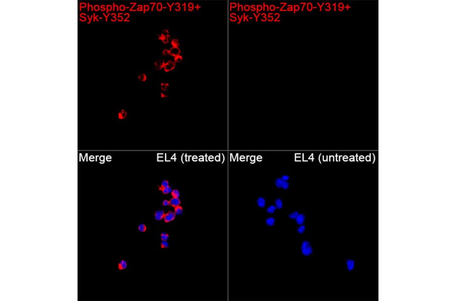 Immunofluorescence - Anti-Zap70 + Syk (Phospho Y319 & Phospho Y352) Antibody (A329878) - Antibodies.com
