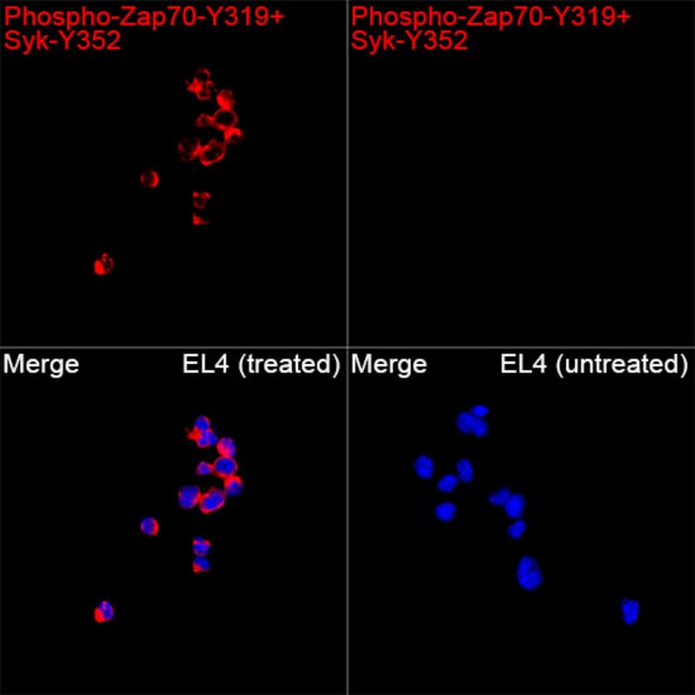 Immunofluorescence - Anti-Zap70 + Syk (Phospho Y319 & Phospho Y352) Antibody (A329878) - Antibodies.com