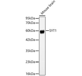 Western Blot - Anti-SYT1 Antibody (A329879) - Antibodies.com