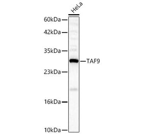 Western Blot - Anti-TAF9 Antibody (A329882) - Antibodies.com