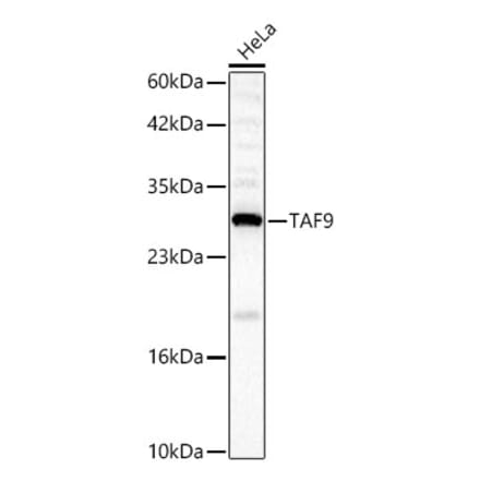 Western Blot - Anti-TAF9 Antibody (A329882) - Antibodies.com