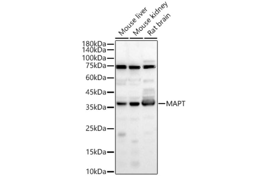 Western Blot - Anti-Tau Antibody (A329883) - Antibodies.com