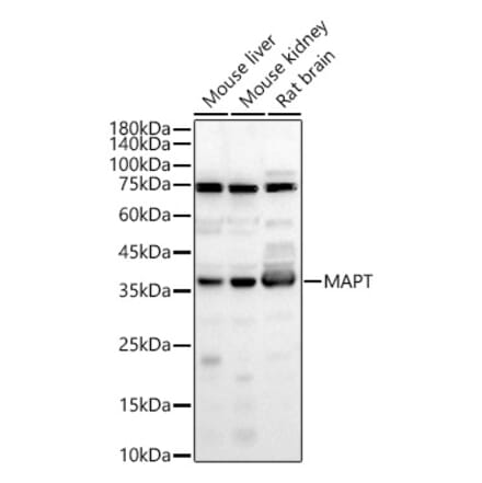 Western Blot - Anti-Tau Antibody (A329883) - Antibodies.com