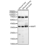 Western Blot - Anti-Tau Antibody (A329883) - Antibodies.com