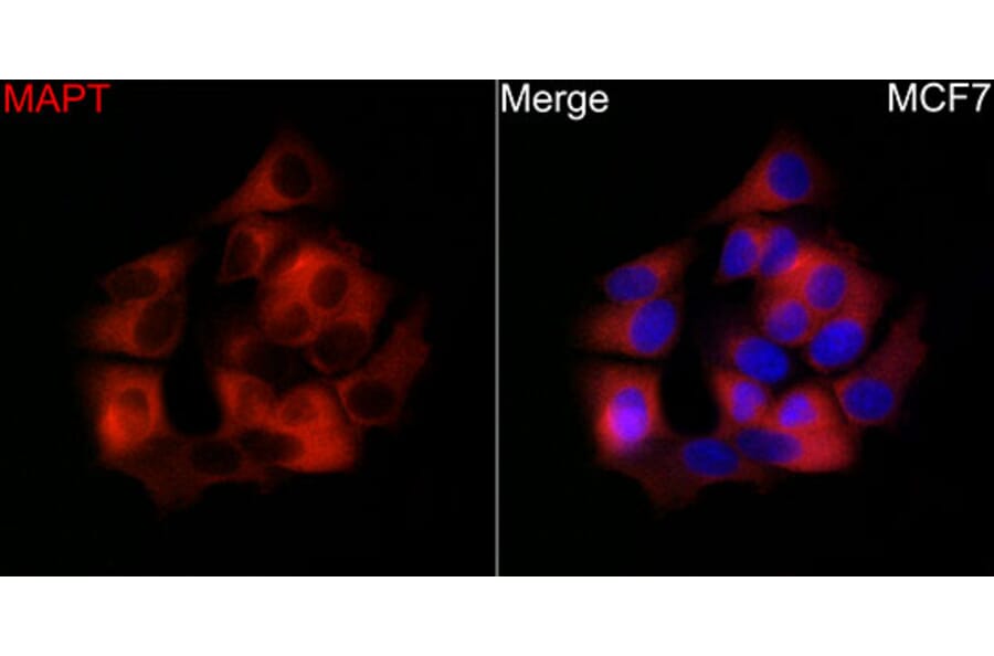 Immunofluorescence - Anti-Tau Antibody (A329883) - Antibodies.com