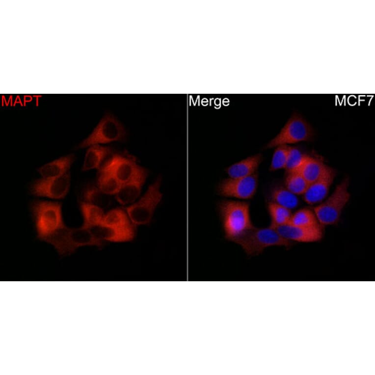 Immunofluorescence - Anti-Tau Antibody (A329883) - Antibodies.com