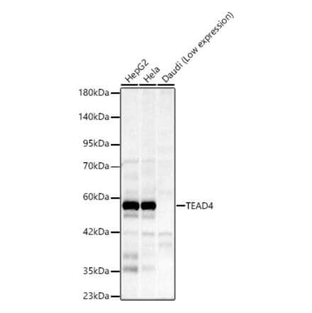 Western Blot - Anti-TEAD4 Antibody [ARC59949] (A329884) - Antibodies.com
