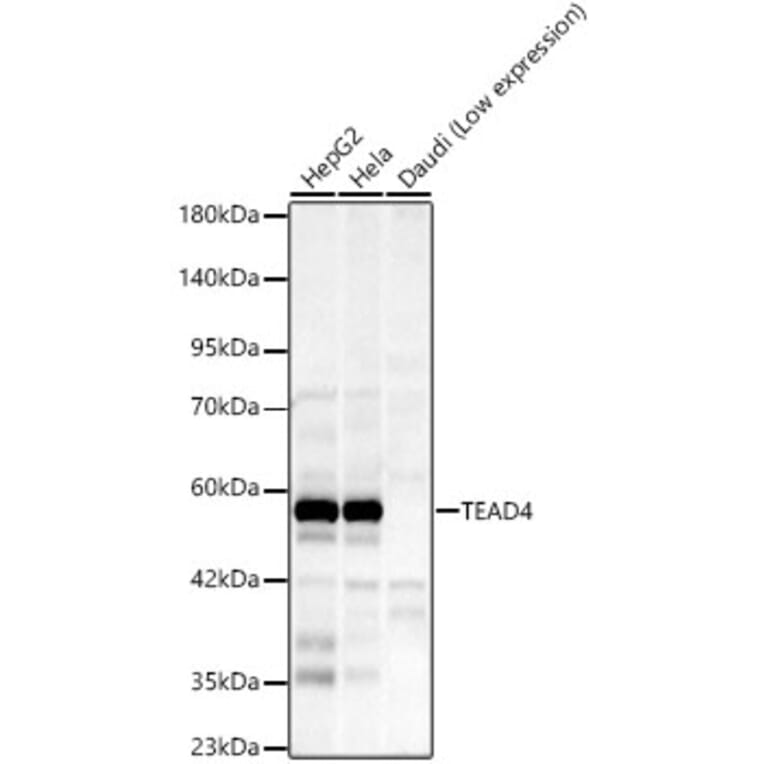 Western Blot - Anti-TEAD4 Antibody [ARC59949] (A329884) - Antibodies.com