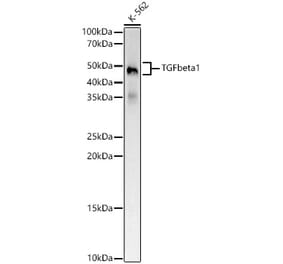 Western Blot - Anti-TGF beta 1 Antibody [ARC5123-07] (A329886) - Antibodies.com