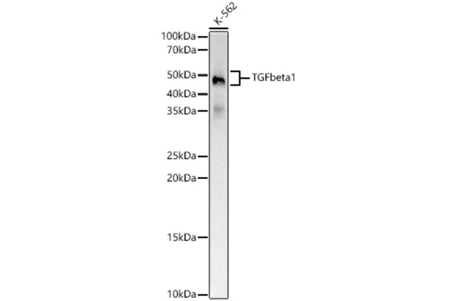 Western Blot - Anti-TGF beta 1 Antibody [ARC5123-07] (A329886) - Antibodies.com