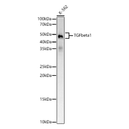 Western Blot - Anti-TGF beta 1 Antibody [ARC5123-07] (A329886) - Antibodies.com