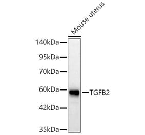 Western Blot - Anti-TGF beta 2 Antibody (A329887) - Antibodies.com