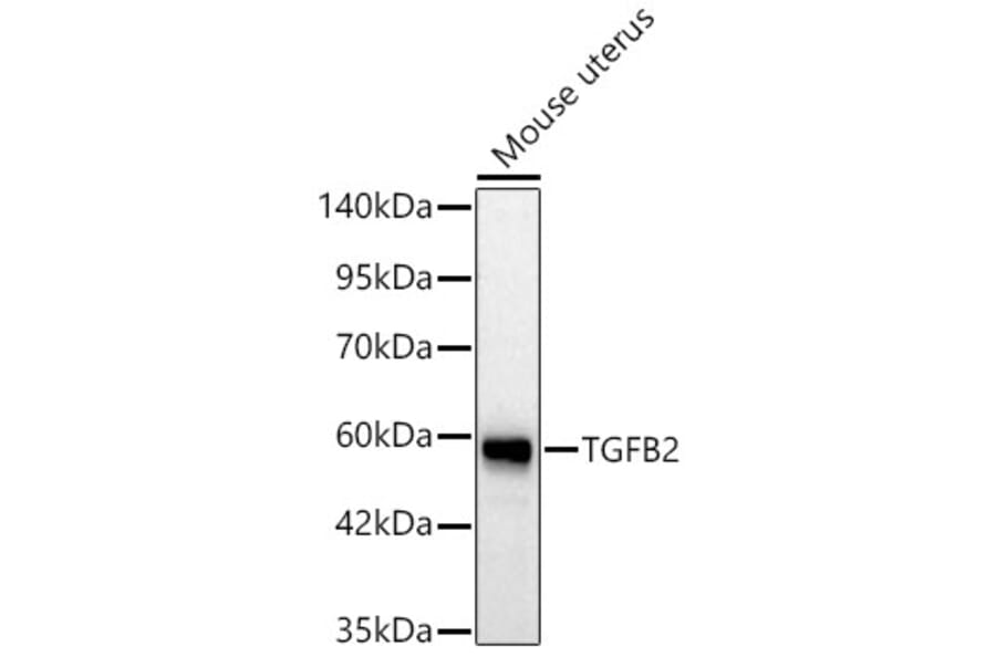 Western Blot - Anti-TGF beta 2 Antibody (A329887) - Antibodies.com