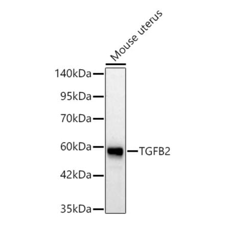 Western Blot - Anti-TGF beta 2 Antibody (A329887) - Antibodies.com