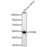 Western Blot - Anti-TGF beta 2 Antibody (A329887) - Antibodies.com