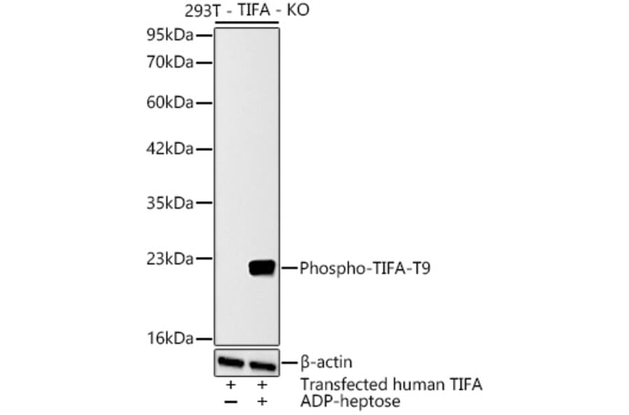 Western Blot - Anti-TIFA (Phospho T9) Antibody (A329890) - Antibodies.com