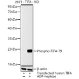 Western Blot - Anti-TIFA (Phospho T9) Antibody (A329890) - Antibodies.com