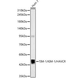 Western Blot - Anti-Tim-1 Antibody (A329893) - Antibodies.com