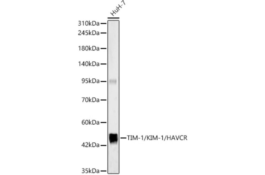 Western Blot - Anti-Tim-1 Antibody (A329893) - Antibodies.com