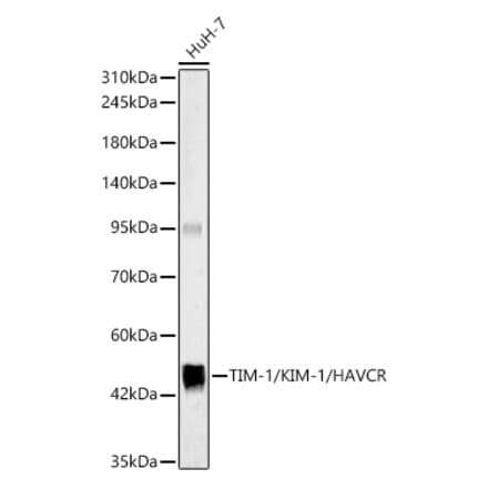 Western Blot - Anti-Tim-1 Antibody (A329893) - Antibodies.com