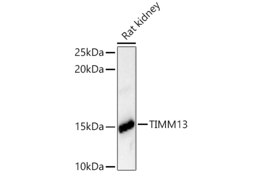 Western Blot - Anti-TIMM13 Antibody (A329894) - Antibodies.com