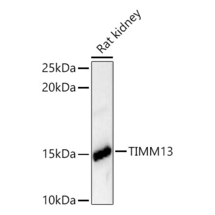 Western Blot - Anti-TIMM13 Antibody (A329894) - Antibodies.com